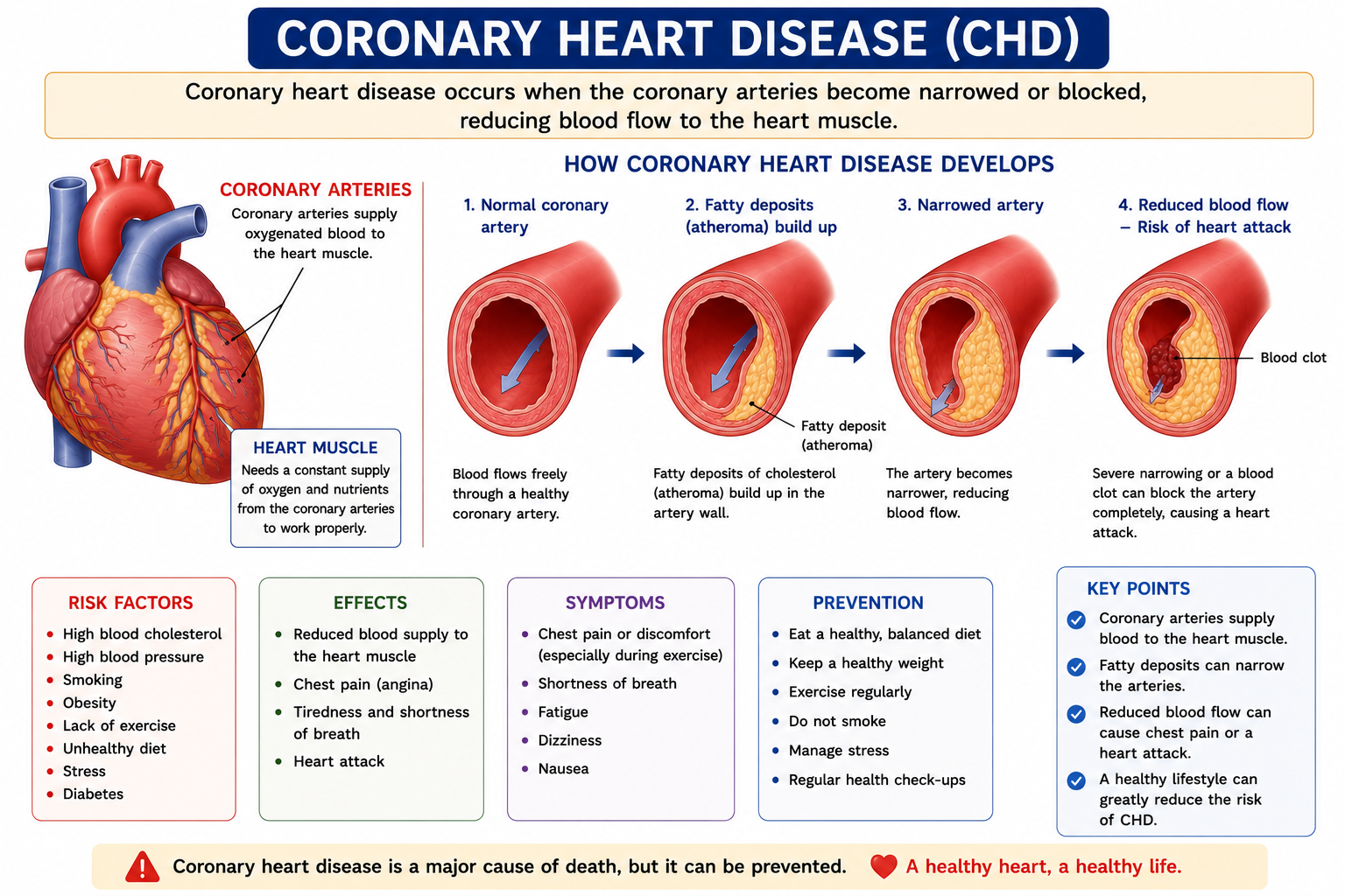 Coronary heart disease diagram showing fatty deposits narrowed coronary artery and reduced blood flow